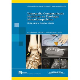 Tomografía computarizada multicorte en patología muscoloesquelética (PANA-00082)