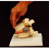 Simulador vertebral con hernia discal.  (VER-00001)