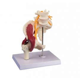 Modelo anatómico de Cadera con musculatura y nervio ciático (ER-4049)